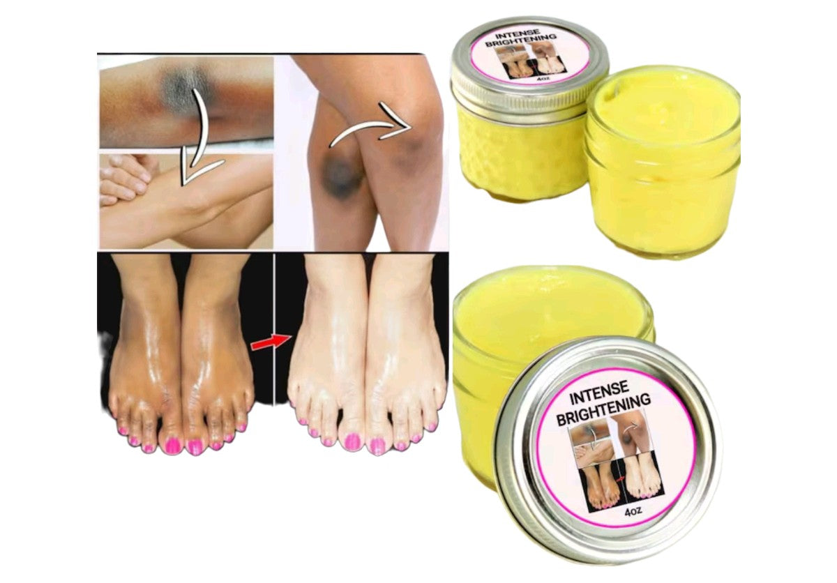 Crème Anti quinto genoux, pieds & coudes 100G